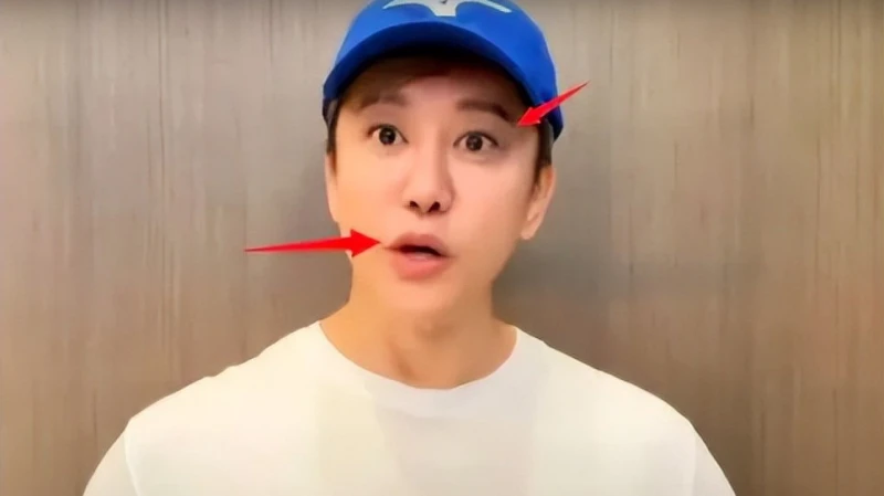毛寧整容後氣質大變，帥大叔變精神小伙托尼，臉僵嘴歪但確實年輕