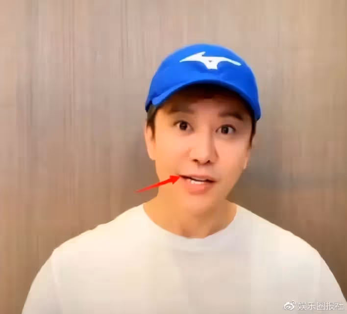 毛寧整容後氣質大變，帥大叔變精神小伙托尼，臉僵嘴歪但確實年輕