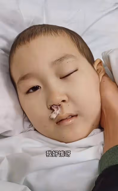 9歲抗癌網紅小旭去世,8年抗癌艱難生涯,歷經3次開顱手術6次化療