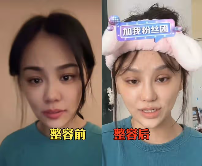 樊小慧自曝整容變化大,立志要逆襲成為林品如,開庭時要靚麗出鏡