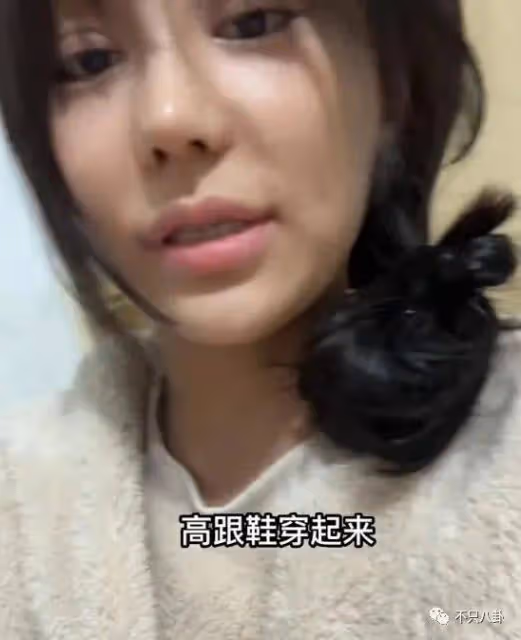 網紅樊小慧去整容了!終究還是對出軌的前任老公意難平啊