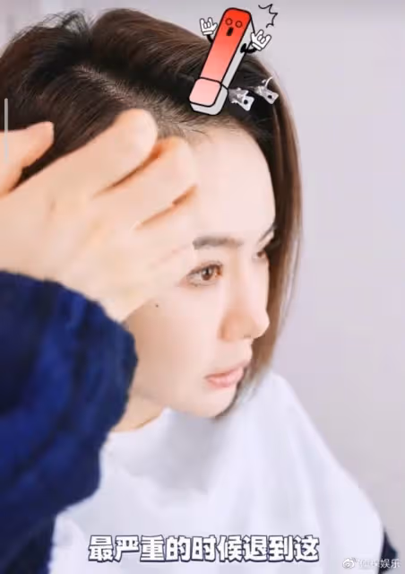 戚薇生二胎脫髮嚴重被老公嘲笑,幽默反擊李承鉉是「禿頭小寶貝」
