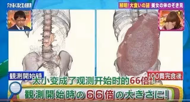 日本魔女大胃王患腸癌病逝,曾經10分鐘吞下399碗面,強到被禁賽