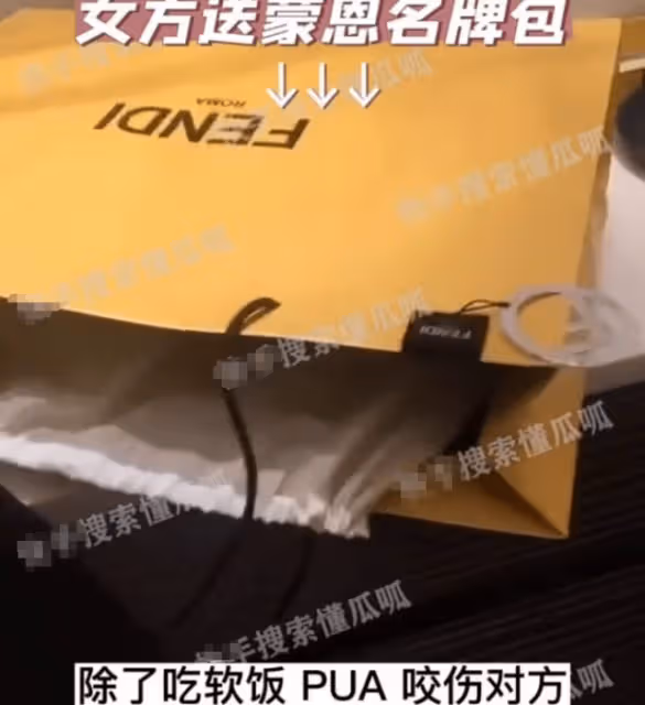 醜聞大瓜!5年女友淚訴蒙恩有特殊癖好咬傷自己,偷偷劈腿女富婆