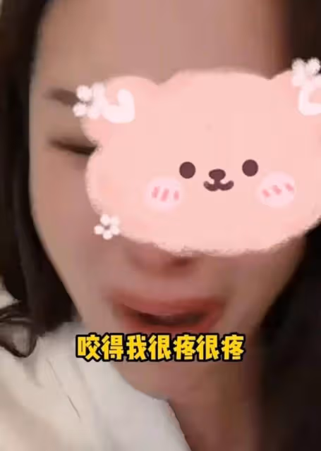 醜聞大瓜!5年女友淚訴蒙恩有特殊癖好咬傷自己,偷偷劈腿女富婆