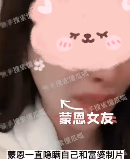 醜聞大瓜！5年女友淚訴蒙恩有特殊癖好咬傷自己，偷偷劈腿女富婆