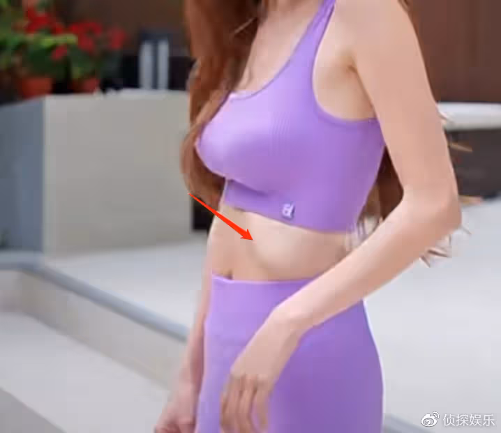 鄭嘉穎嬌妻生三胎兩月瘦成皮包骨,肚子凹陷肋骨突出,身材仍有料