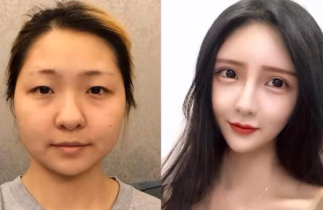 頂著一張「假」臉演戲？這4個整容女星，看到後確實不入戲