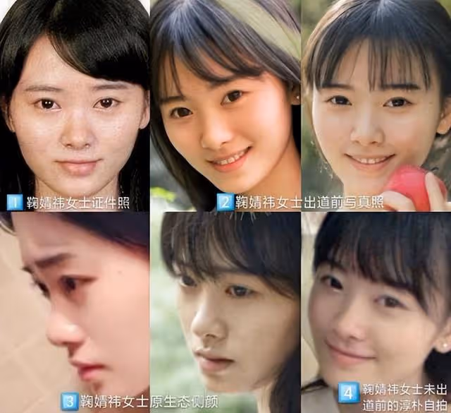 頂著一張「假」臉演戲？這4個整容女星，看到後確實不入戲
