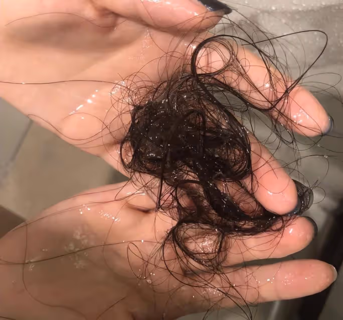 頭頂越洗越禿？做好這三步，洗完不掉發，碎發還能滿頭炸！