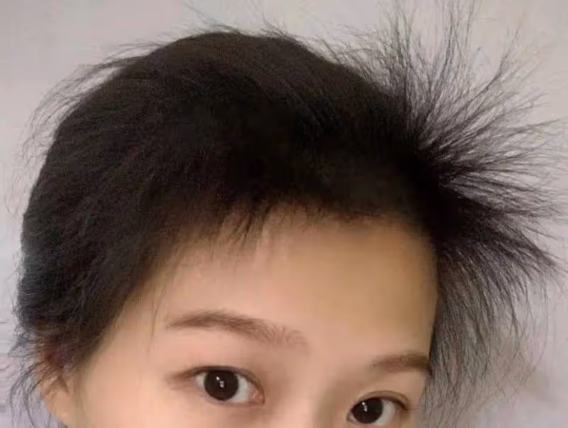 頭頂越洗越禿？做好這三步，洗完不掉發，碎發還能滿頭炸！