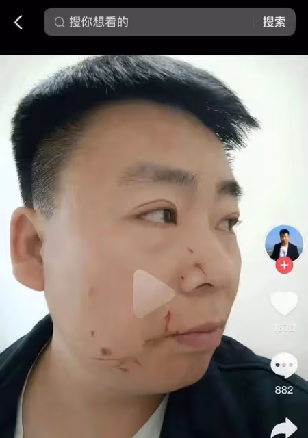 男網紅稱因合成熱巴視頻被打!網友:這算不算隔空性騷擾?