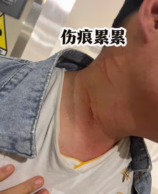 突發！導演蔣叢帶人群毆劇組統籌，放話：往死里打，報警也沒有用
