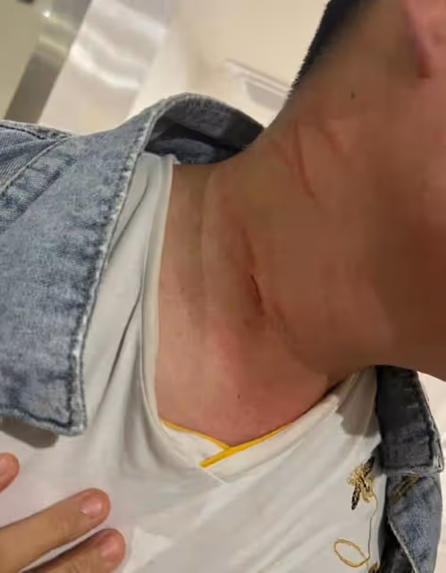 曝知名導演帶人群毆統籌,受害者滿身血多處挫傷,被威脅報警沒用