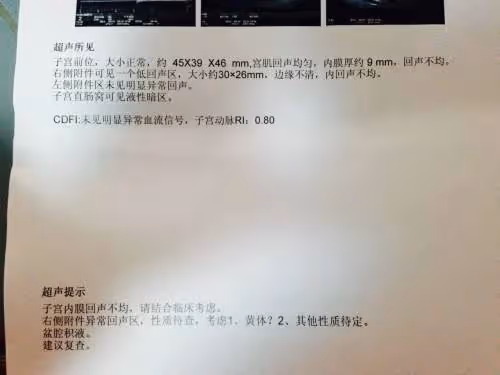 兒媳只要2萬彩禮,我以為撿到了寶,直到我看見她的診斷證明!