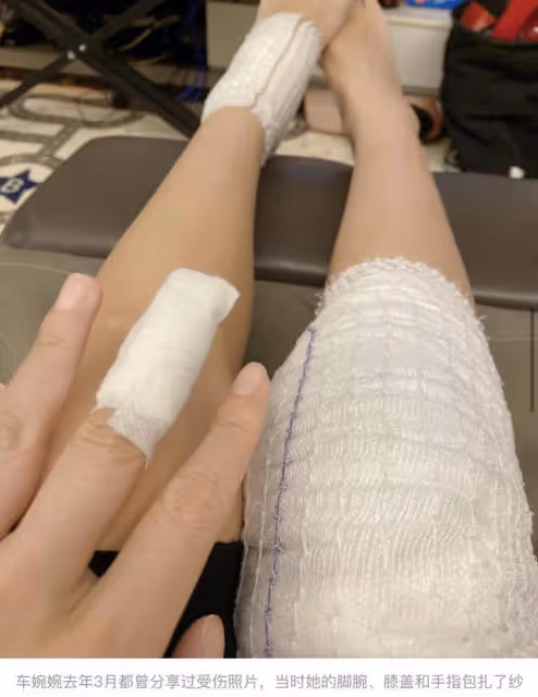 陳小春舊愛疑被外籍老公家暴,傷痕累累哭腫眼,混血寶寶也曾受傷