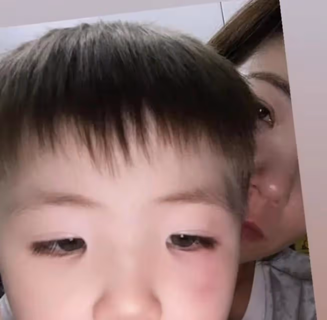 陳小春舊愛疑被外籍老公家暴,傷痕累累哭腫眼,混血寶寶也曾受傷