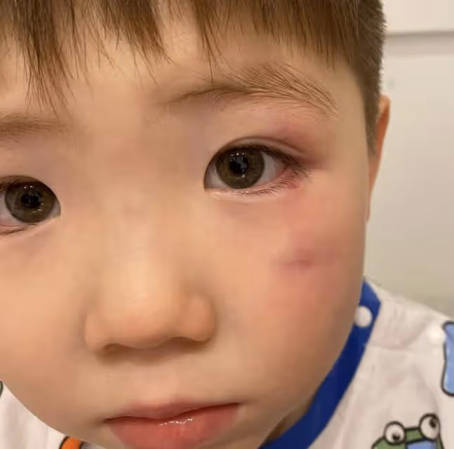 陳小春舊愛疑被外籍老公家暴,傷痕累累哭腫眼,混血寶寶也曾受傷