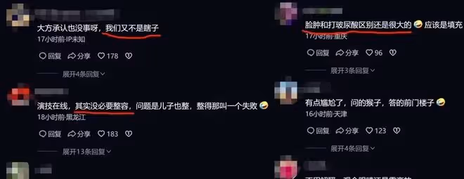 60歲演員吳剛被曝已經出國,臉上看著正常多了,疑似已經做完手術