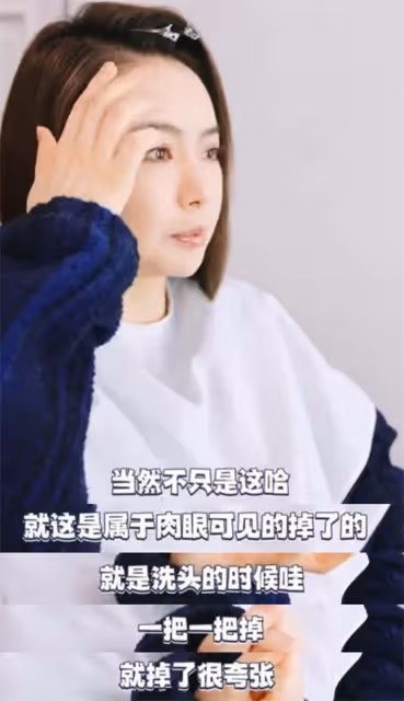戚薇生二胎後狂脫髮,李承鉉嘲笑嬌妻反被侃禿頭