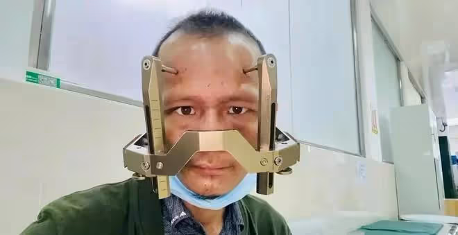 41歲抗癌網紅凱哥去世,曾被醫生斷言活不過半年,苦撐八年創奇蹟
