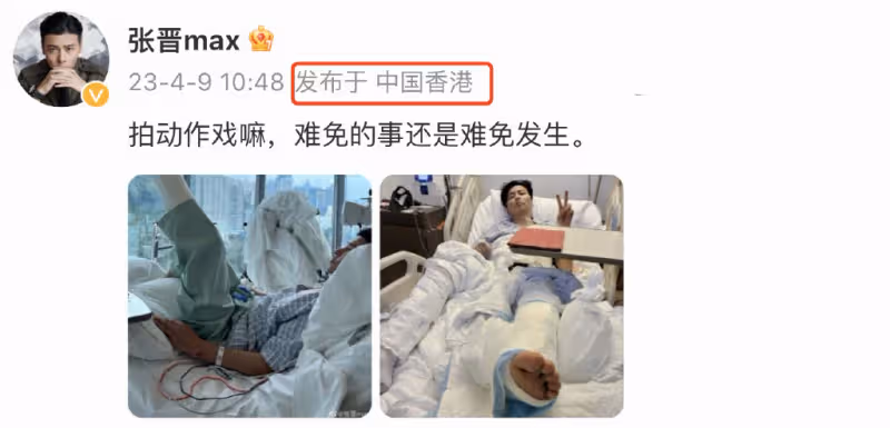 張晉曬病床照左腿打石膏,因拍戲受傷緊急做手術,蔡少芬報平安