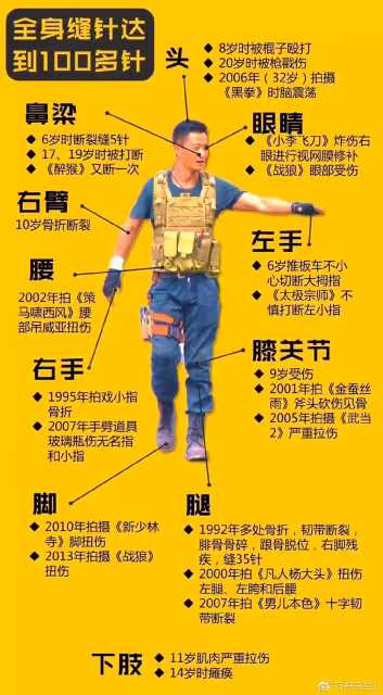 張晉曬病床照左腿打石膏,因拍戲受傷緊急做手術,蔡少芬報平安