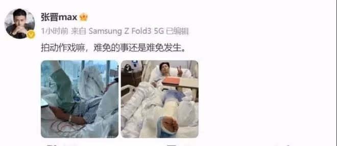 突發!蔡少芬老公張晉受重傷住院,鼻子插著氧氣,雙腿打滿了石膏