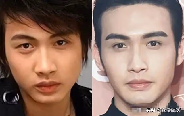 娛樂圈染上「整容」癮,一言不合就往臉上動刀子,有人因此而喪命
