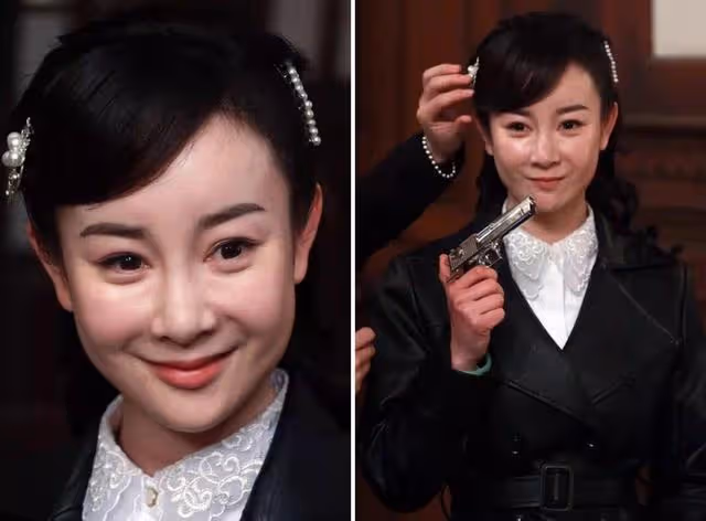 娛樂圈染上「整容」癮,一言不合就往臉上動刀子,有人因此而喪命