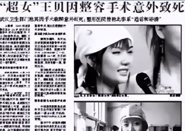 娛樂圈染上「整容」癮,一言不合就往臉上動刀子,有人因此而喪命
