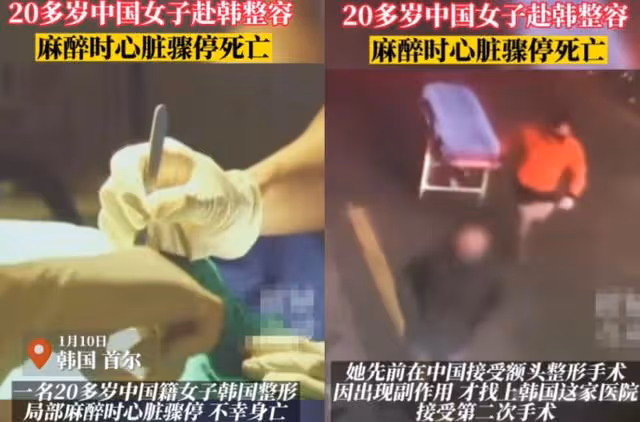 娛樂圈染上「整容」癮,一言不合就往臉上動刀子,有人因此而喪命