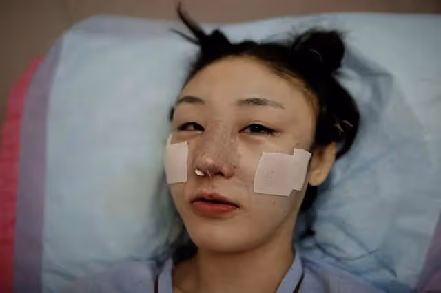 娛樂圈染上「整容」癮,一言不合就往臉上動刀子,有人因此而喪命