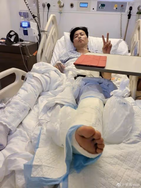 張晉拍戲受重創緊急送院動刀 蔡少芬嚇破膽