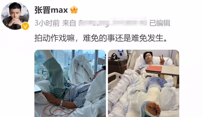 突發!知名男星張晉拍戲出事送醫,插鼻喉緊急開刀