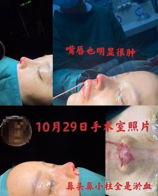 演員高溜整容失敗，在這看臉的時代，容貌對於演員是否大於演技