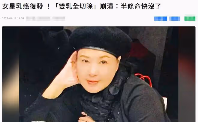 72歲女星癌症復發!術後情緒失控,直言寧願死都不會同時化療電療