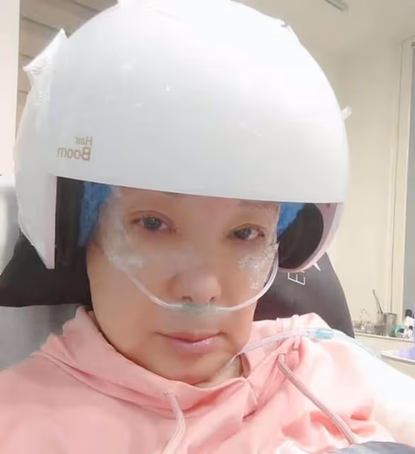 72歲女星癌症復發!術後情緒失控,直言寧願死都不會同時化療電療