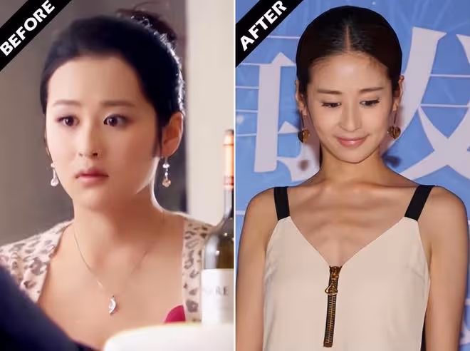 濾鏡下是美女，現實中是「女鬼」！這些瘦到病態的明星，真辣眼
