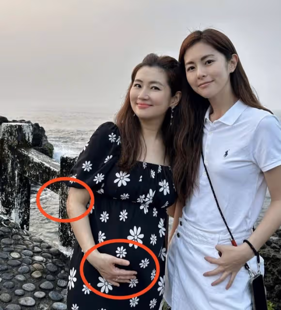 Selina曬全家出遊照,手捧孕肚出鏡,手臂燒傷疤痕曝光太讓人心疼