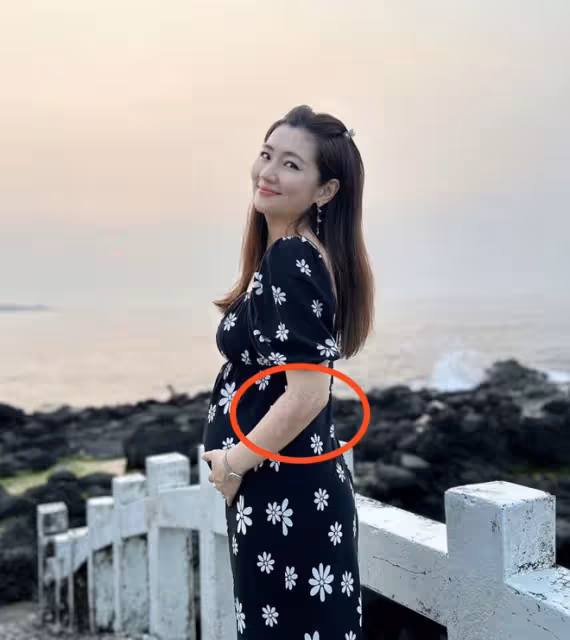 Selina曬全家出遊照,手捧孕肚出鏡,手臂燒傷疤痕曝光太讓人心疼