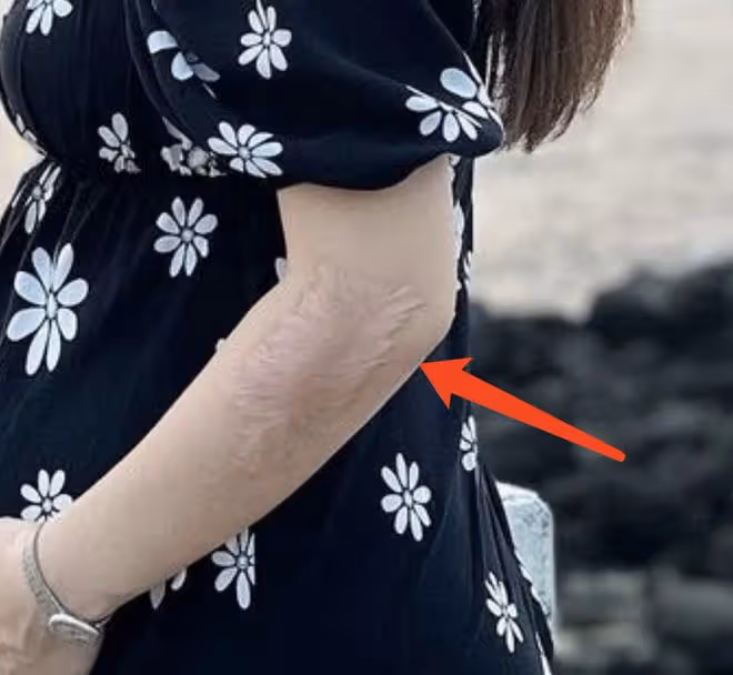 Selina曬全家出遊照，手捧孕肚出鏡，手臂燒傷疤痕曝光太讓人心疼