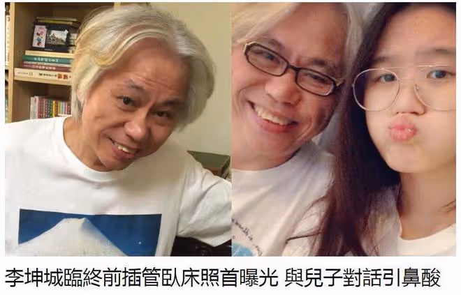 林靖恩公開李坤城臨終照片：臉部腫脹，喉嚨和鼻子在插管治療