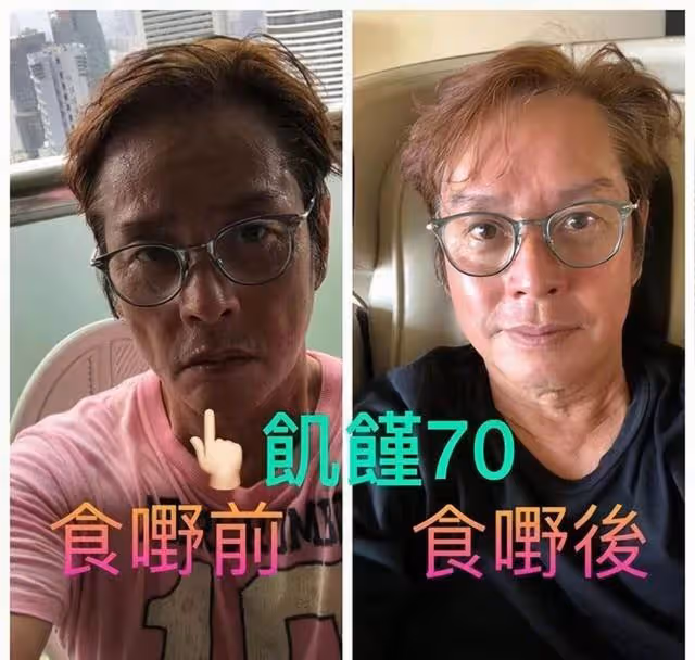 香港知名男星被質疑患糖尿病,近照腿細肚子大,像懷孕5個月