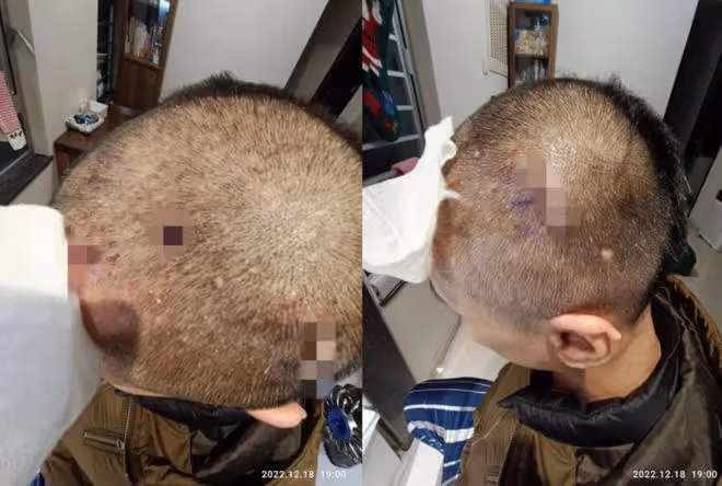 知名港星被曝遭富婆妻子家暴,網友一面倒叫好!曾出軌並毆打前妻