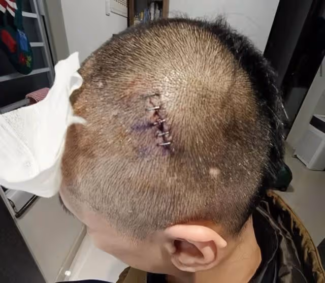 突發!香港知名男星被曝遭家暴後反被拘捕,妻子本人親自報警