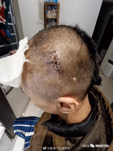 世紀賤男周永恆遭太太施暴？陳薇首開腔回應看《愛回家》觀眾是白痴
