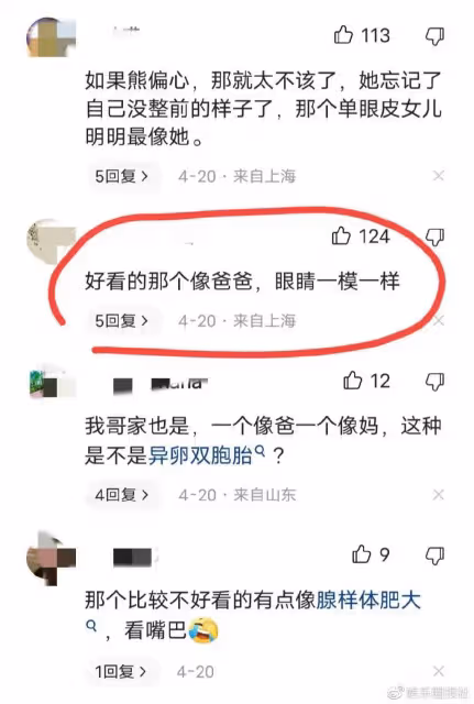 熊黛林異卵女兒被熱議，孩子長相對此太慘烈，被質疑偏心漂亮那個