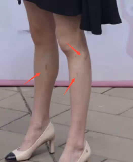 毛阿敏現身女兒成人禮,女兒化濃妝腿上傷痕明顯,母女看起來不熟