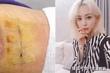 韓藝瑟醫美痕跡明顯?劇中曾飾演整容女神 遇醫療事故心理創傷大
